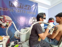 Mahtan Gelar Hapus Tato Gratis di Makassar